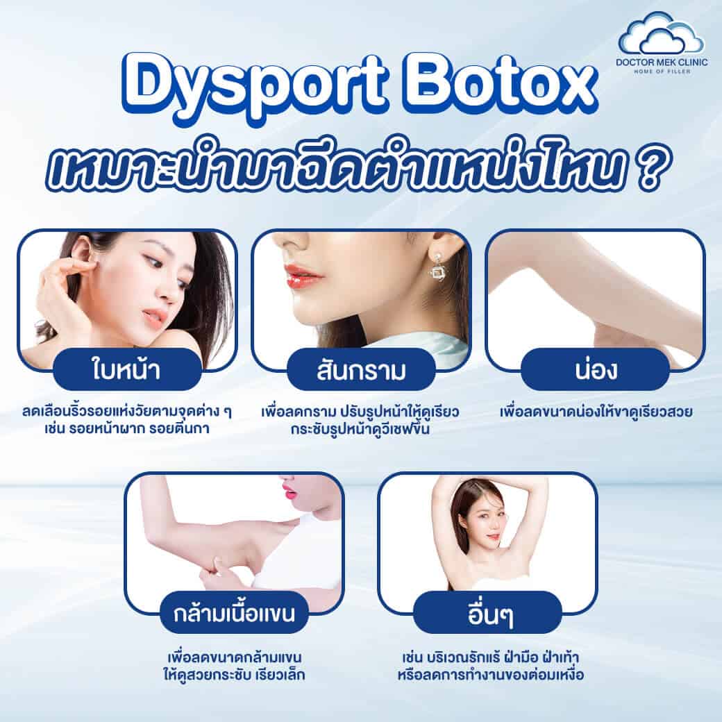 Dysport Botox เหมาะสำหรับนำมาฉีดตำแหน่งไหนได้บ้าง
