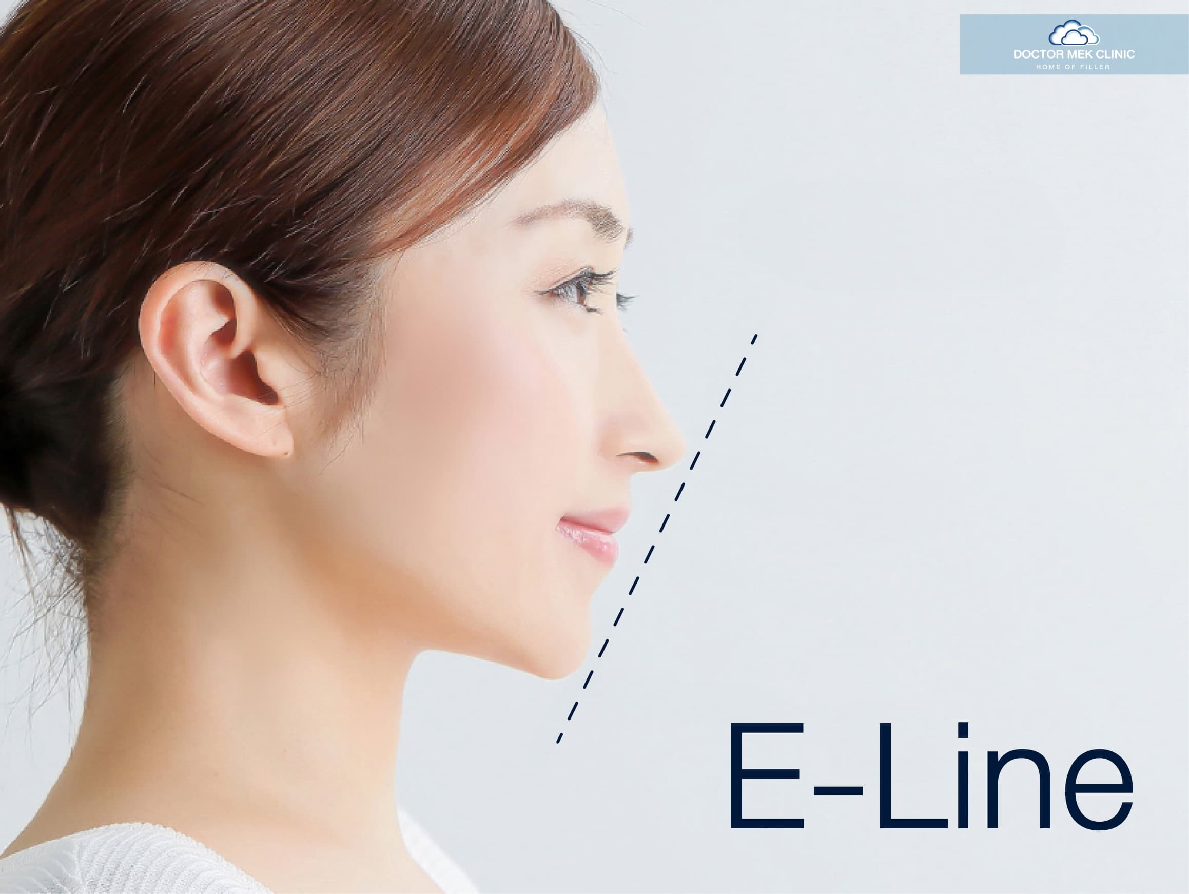 E-Line