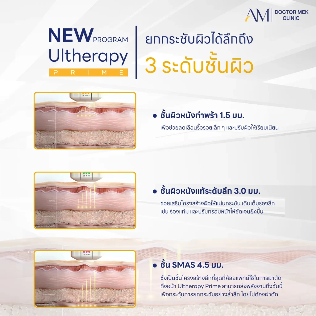 Ultehrapy Prime ยกกระชับผิวได้ลึกถึง 3 ระดับชั้นผิว