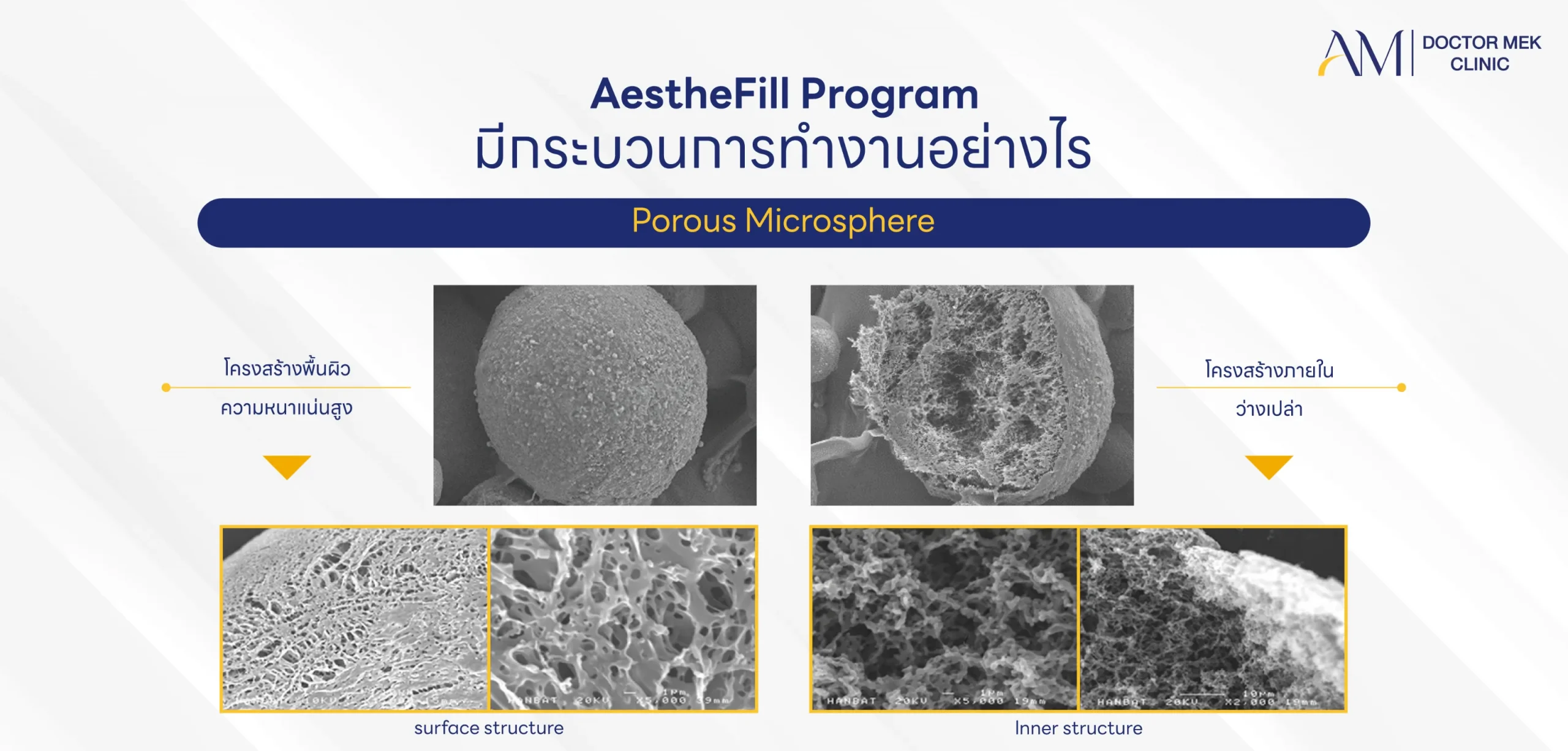 กระบวนการทำงานของ โปรแกรม AestheFill