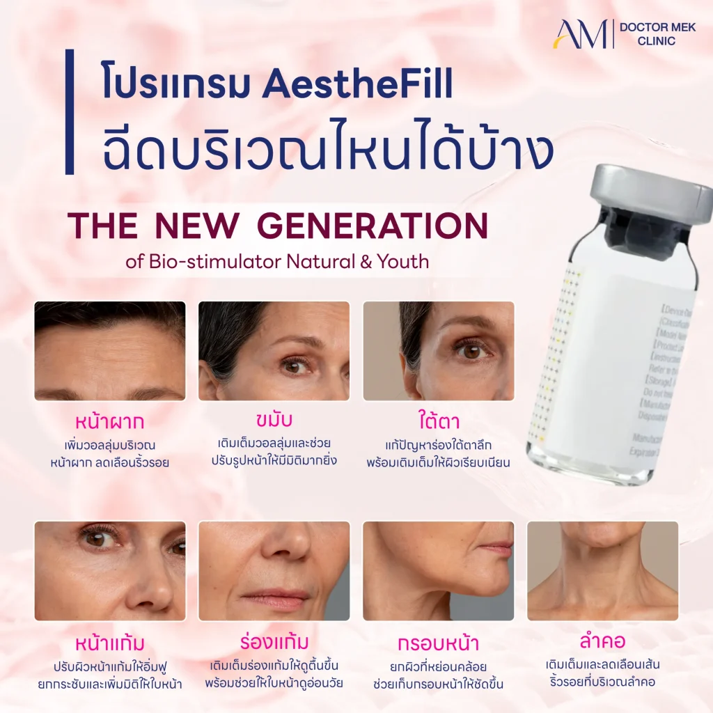 โปรแกรม AestheFill ฉีดบริเวณไหนได้บ้าง