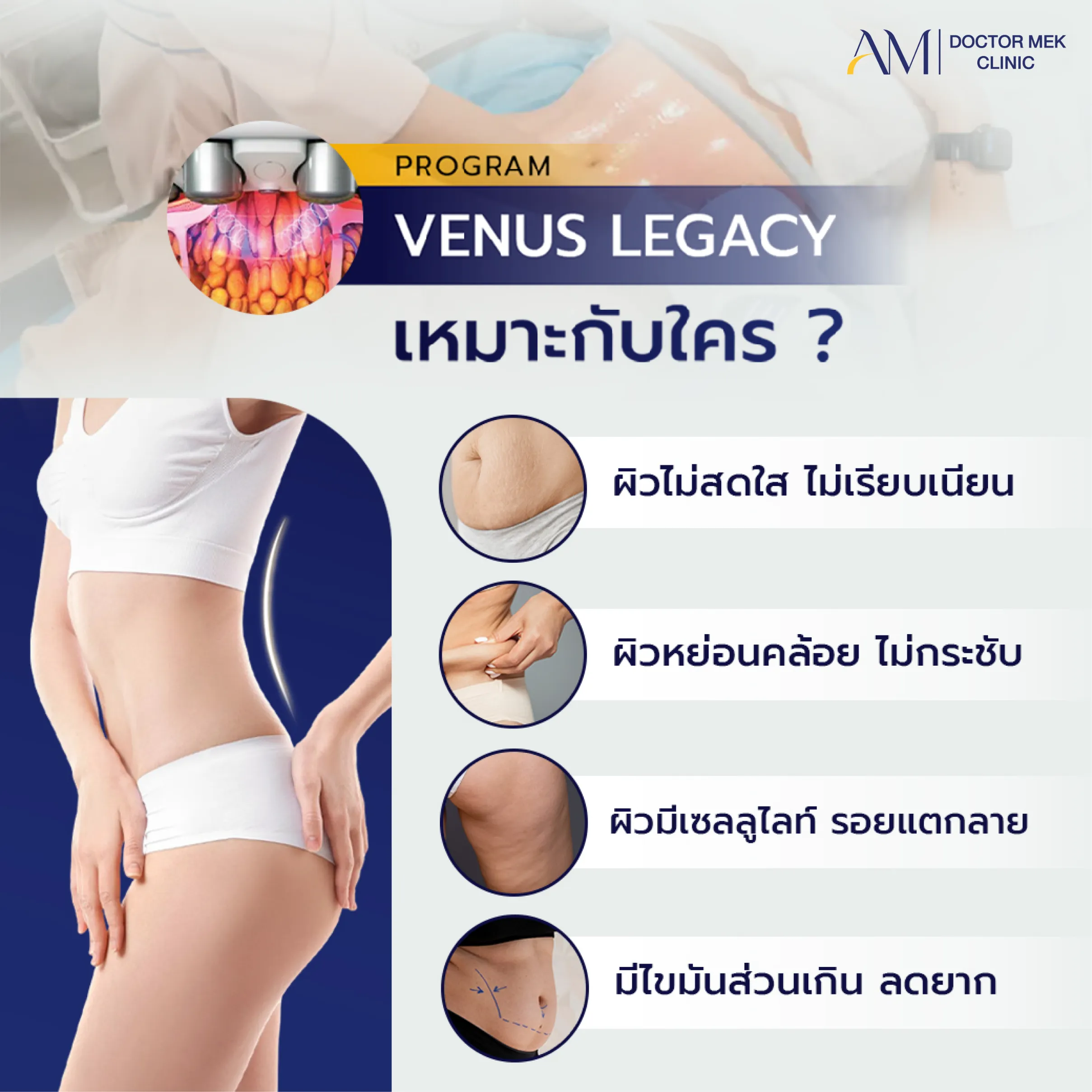 โปรแกรม venus legacy เหมาะกับใคร